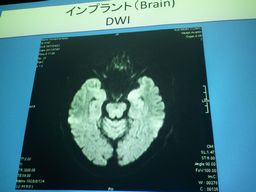 MRI.3.jpg