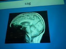 MRI.2.jpg